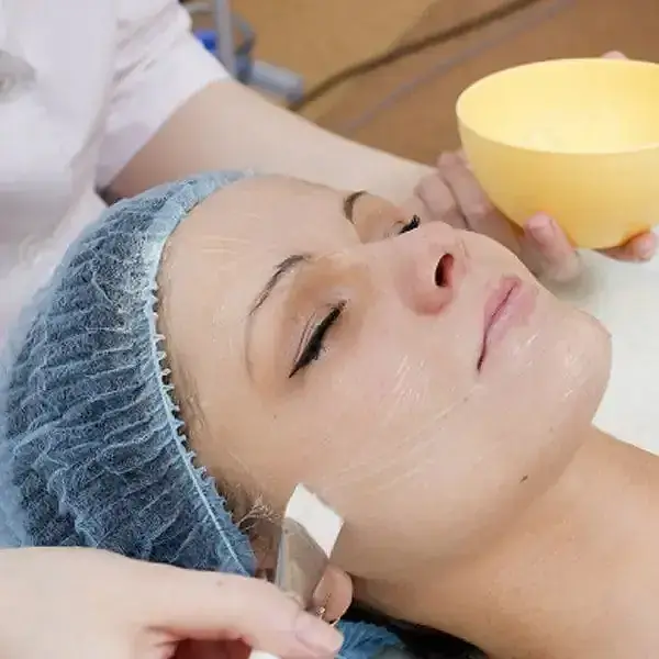 Peeling químicos